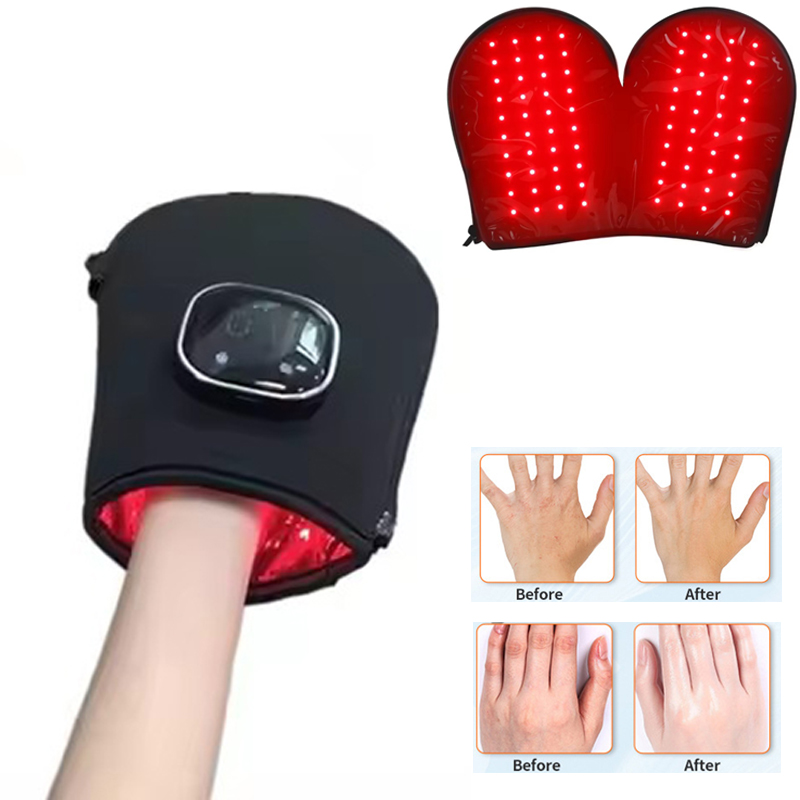 Heated Gloves Electric - Nowe urządzenie do terapii czerwonym światłem